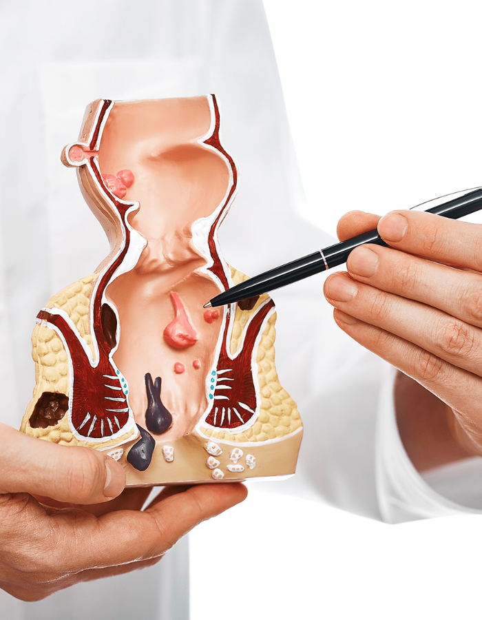 Dr eleri piles clinic